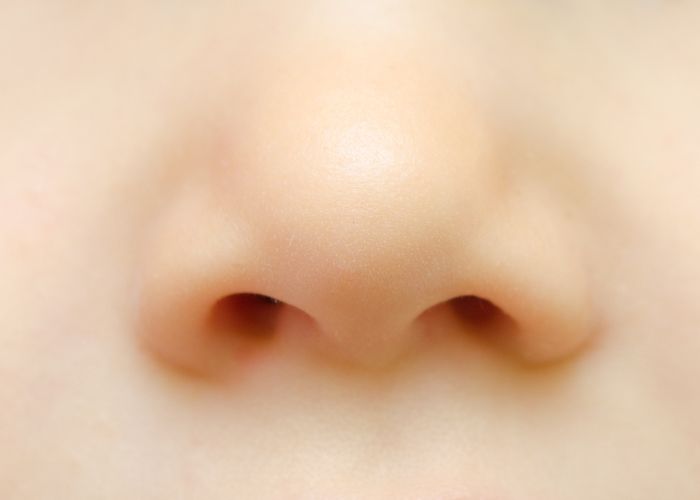 obstrucción nasal crónica