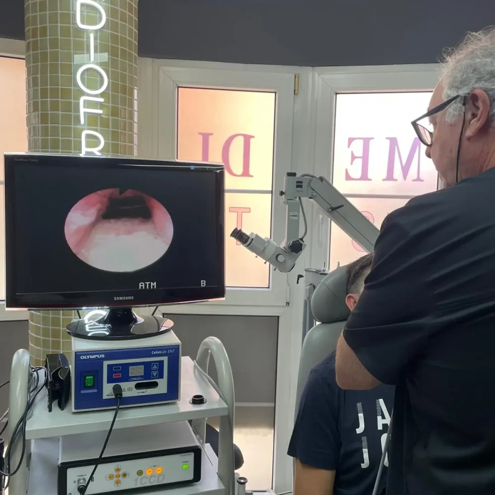 Clinica del Dr Delgado Aboy Turbinoplastia Por Radiofrecuencia